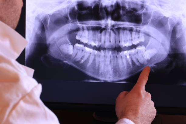 Best Emergency Dental Surgery in Montverde, FL